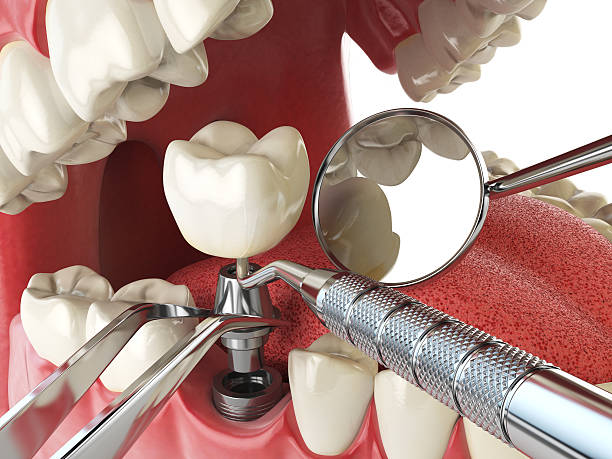 Best Emergency Dental Surgery in Northford, CT